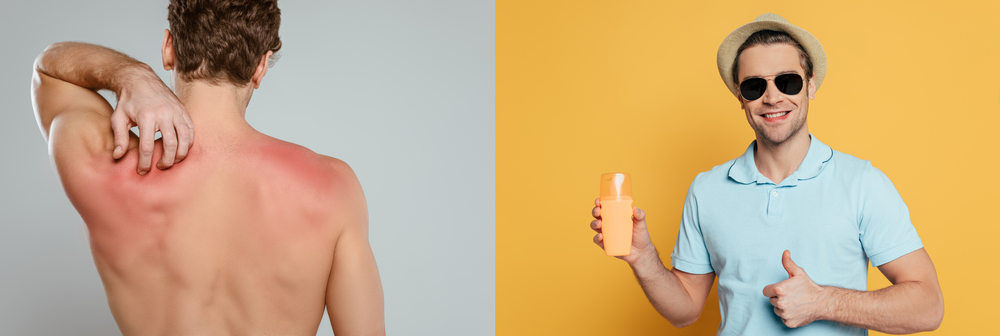 Summer Vacation Safety Tips.
Man with sunburn and man suggesting sunscreen.