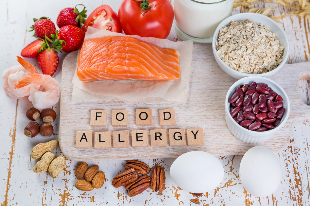 Food allergies - food concept with major allergens, rustic wood background.
Travel Blog Post Ideas